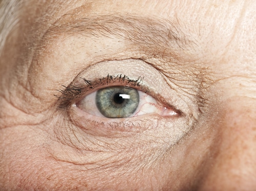 Closeup of an eye